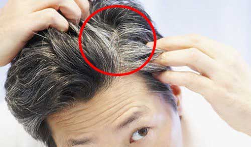 逆转白头发！从此不用再花钱买染发剂了！